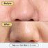 Remedy for Pore Size, Large Pore Minimizer with Retinol & Niacinamide for Uneven Texture