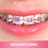 2080 Ligature Ties for Braces, Multicolor Dental Orthodontic Ties for Brackets, 2 Bags of 1040