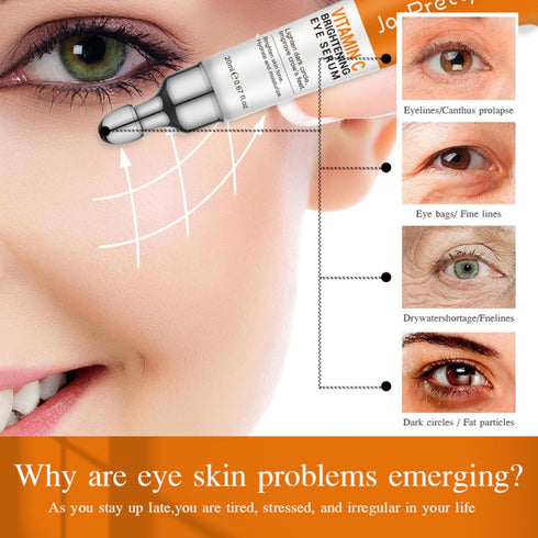 JoyPretty New Vitamin C Eye Serum, Anti-Aging Eye Cream with Niacinamide and Hyaluronic Acid for Dark Circles Puffiness