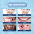 30 ml Temporary Teeth Replacement Kit, Tooth Repair Kit - Moldable Thermal Fitting Beads for Filling Missing Broken