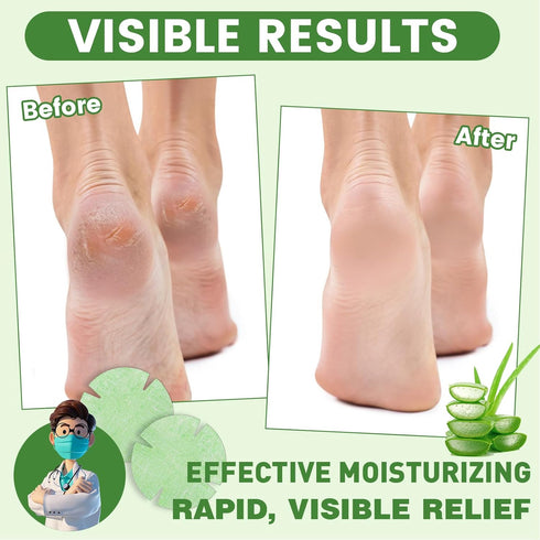 TEAWOO 30PCS Patented Aloe Vera Cracked Heel Treatment Patches, New Upgraded Cracked Heel Repair Bandage