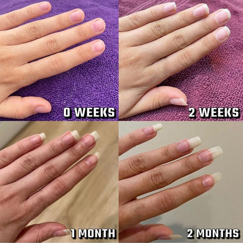 Radiant Nail Growth Oil, Nail Strengthener and Cuticle Oil for Moisturizing Nail Care, Anti-Hangnail Pen