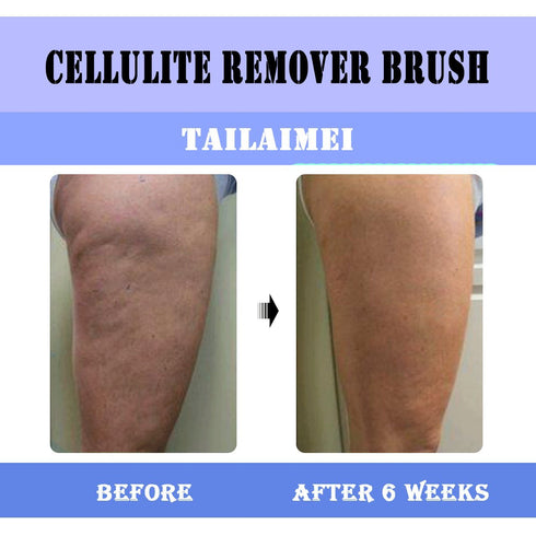 TailaiMei Anti Cellulite Massager Brush - Body Shower Scrubber for Circulation & Muscle Release (Blue)