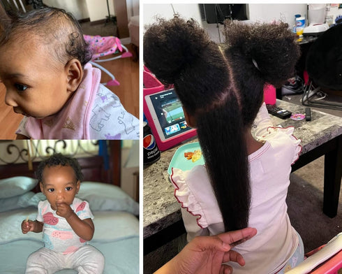 Natural Baby Kids Hair Care Products Extra Strength Growing & Nourishing Children Hair Growth Grow Serum Oil,Black Seed Oil for powerful Hair growth - Thick and Full