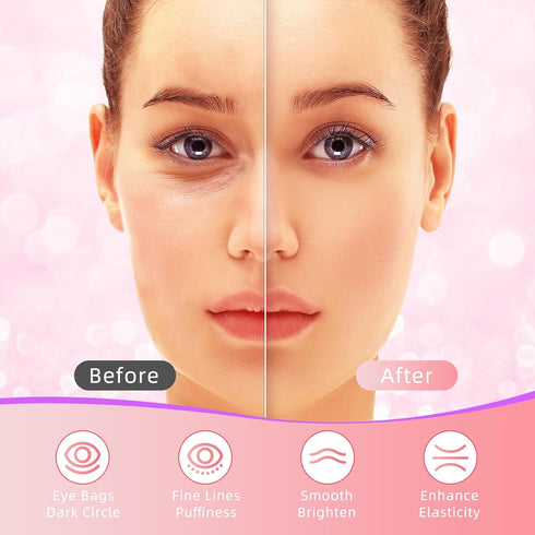 Under Eye Patches, 40 Pairs Eye Mask for Dark Circles, Puffy Eyes, Wrinkles, Eye Treatment Skin Care for Men & Women