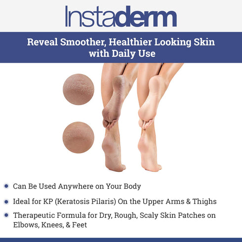 KP Bump Eraser Keratosis Pilaris Treatment - Smoothing Exfoliating Moisturizing Lotion with Lactic Acid, AHA for Bumpy