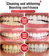 2Pcs Super Probiotic SP-6 Toothpaste, Whitening Toothpaste for Fresh Breath and Deep Cleaning Care