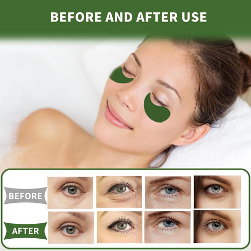 Under Eye Patches 70PCS - Green Tea Eye Masks for Dark Circles and Puffiness, Non-Irritating Eye Gel Pads