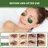 Under Eye Patches 70PCS - Green Tea Eye Masks for Dark Circles and Puffiness, Non-Irritating Eye Gel Pads