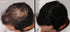 LUXE Hair Thickening Fibers - CONFIDENCE IN A JAR – 2 Months+ Supply! – Gray