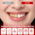 SP-6 (62 Count) Probiotics & Hydroxyapatite Toothpaste Tablets - Remineralizing Enamel Repair, Fluoride-Free Whitening