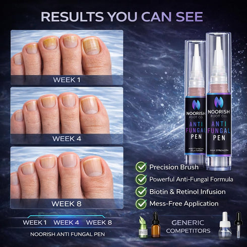 NOORISH FOOT CO. 2 Nail Fungus Treatment Pen for Toenails & Fingernails - Antifungal Nail Repair with Undecylenic Acid