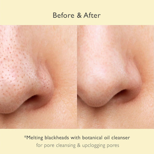 No Pore Cleansing Oil, Makeup Cleansing Oil for Blackheads Removal, Korean Skin Care with Olive Oil & Tea Tree