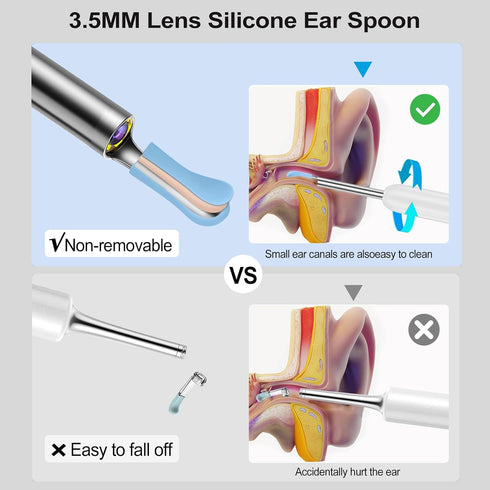 Ear Wax Removal Tool with Camera, 1080P Ear Cleaner with 6 LED Light and 8 Ear Picks for iPhone, iPad, Android