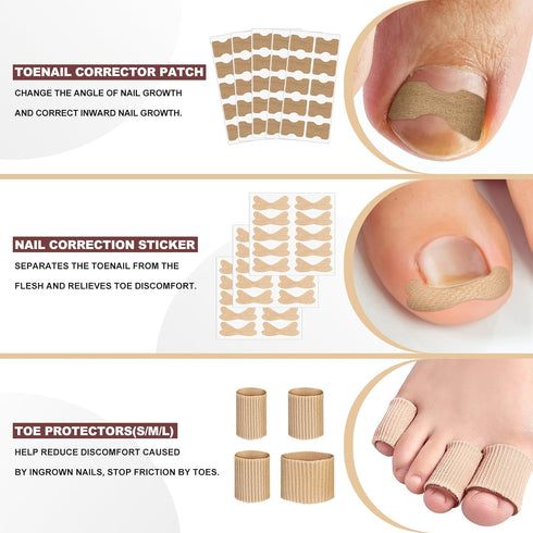 Ingrown Toenail Removal Kit, Professional Tool Kit with Corrector, 50PCS Corrector Patches for Pain Relief