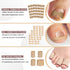 Ingrown Toenail Removal Kit, Professional Tool Kit with Corrector, 50PCS Corrector Patches for Pain Relief