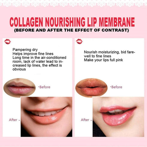 Jakuva 30PCS Collagen Crystal Lip Mask, Gel Lip Pads for Dry Lips, Nourishing & Moisturizing