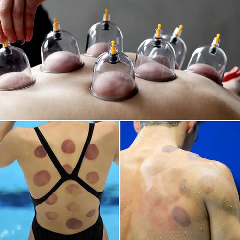 Cupping Kit for Massage Therapy, 32 Cups Professional Chinese Cupping Set with Vacuum Therapy for Cellulite and Muscle