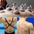 Cupping Kit for Massage Therapy, 32 Cups Professional Chinese Cupping Set with Vacuum Therapy for Cellulite and Muscle