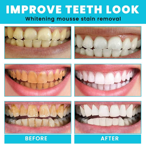Teeth Whitening Mousse - Refreshing Breath Deep Cleaning Foam Toothpaste Natural Mouth Wash Water, Ultra Fine Mousse