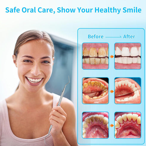 Dental Tools Professional Oral Care Hygiene Kit, Portable 4 Packs Plaque Tartar Remover Cleaner Set