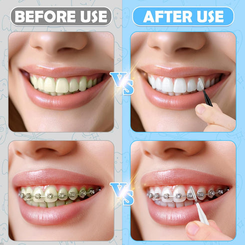 120Pcs Interdental Brushes - 360° Bendable Soft Bristles for Gum Braces Oral Teeth Cleaning Tool (Black, White)
