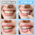 120Pcs Interdental Brushes - 360° Bendable Soft Bristles for Gum Braces Oral Teeth Cleaning Tool (Black, White)