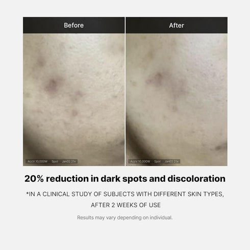 Medicube Deep Vita C Serum 2.0, 14.5% Pure Vitamin C for Hyperpigmentation, Dark Spots, Korean Skincare (10g * 3)