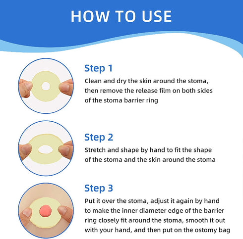 THUJPKU 20 2mm 2mm PCS Ostomy Barrier Rings, Moldable Ostomy Supplies, Flexible Medical Grade Hydrocolloid Ostomy Bag