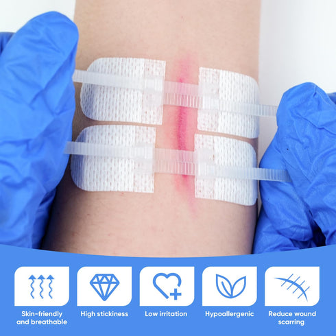 VPRIME SAFETYFY 34 Pack 6PCS Wound Closure Strips, Zip Stitches Wound Closure Kit Repair Wounds Without Stitches