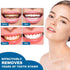 Teeth Whitening Pen, Essence Gel Pen for Whitening Teeth, Reducing Stains & Yellowing (3 pcs)