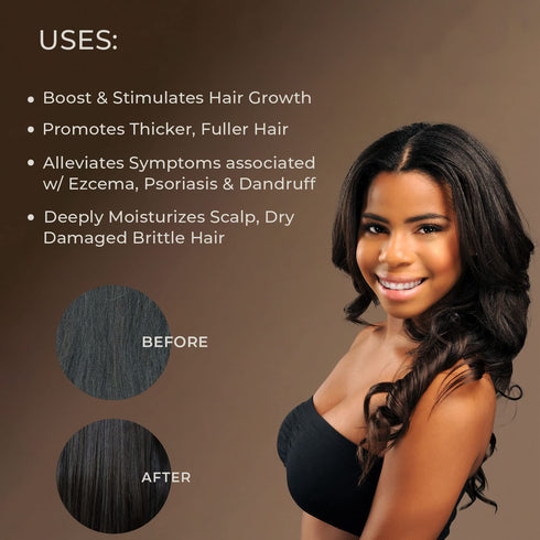 Sunny Isle Extra Dark Jamaican Black Castor Oil, 8 fl. oz. | 100% Natural High Potency Hair & Scalp Treatment
