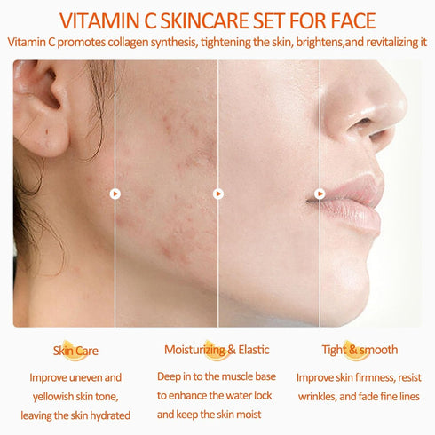 Vitamin C Skincare Set, 5-In-1 Gift Set with Cleanser, Toner, Serum, Cream, and Eye Cream for Women Men