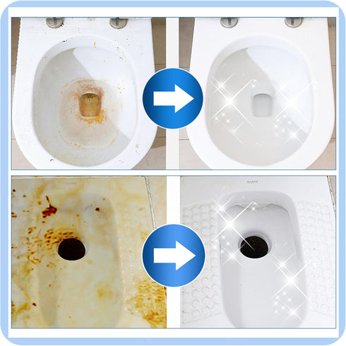 14Pcs Pumice Stone Toilet Bowl Cleaning Brush Set with Long Gloves for Hard Water Ring and Stain Cleaning