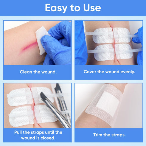 VPRIME SAFETYFY 34 Pack 6PCS Wound Closure Strips, Zip Stitches Wound Closure Kit Repair Wounds Without Stitches