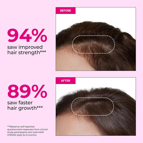 Gummies B12 B12 Gummy 60 Gummies HUM Hair Strong Daily Hair Growth with Biotin, Zinc, Vitamin to Support Growth, Folic