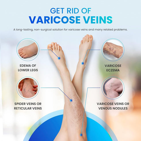 OWELL NATURALS Varicose Vein Cream for Legs - 2oz Maximum Strength All Natural Discomfort Reliever for Muscle