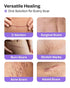 AWD Silicone Scar Sheets for Surgical Scars, Medical Grade Silicone Scar Tape for C Section, 1.6" x 120" Roll