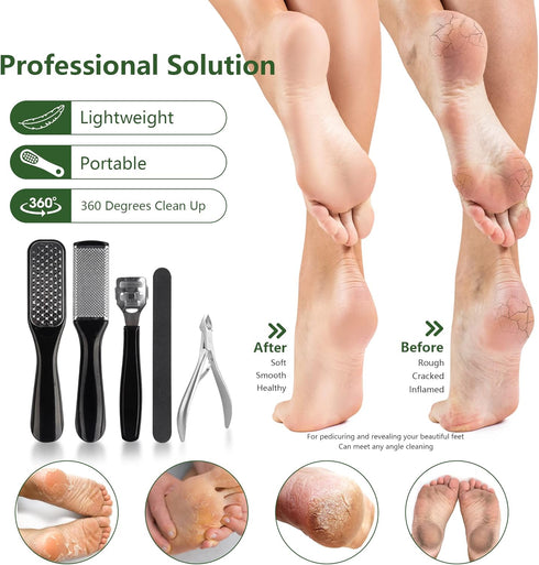 Professional 30PCS Manicure and Pedicure Tool Kit, Exfoliation Foot File Set for Women and Men at Home or Travel
