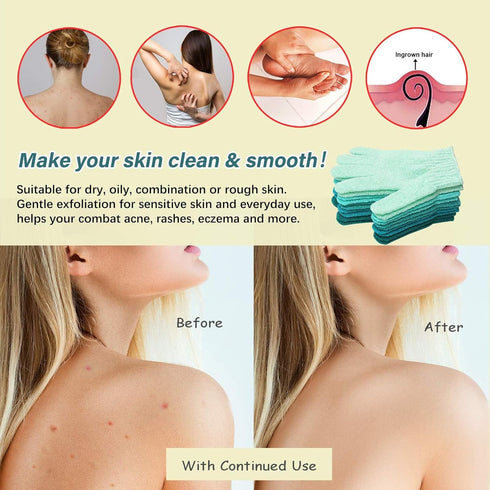 MIG4U Medium to Heavy Shower Exfoliating Scrub Gloves - 5 Pairs for Deep Cleansing and Dead Skin Removal