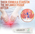 MOHNARK 30 Maximum Strength Lidocaine Hemorrhoid Treatment Cream for External and Internal Hemorrhoids Treatment Burn