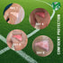 TURFGUARD Turf Burn and Wound Dressing, 2" x 3" Hydrogel Pads with X-Static Silver, Soothing Cooling Protective