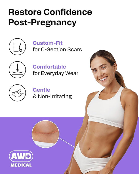 AWD Silicone Scar Sheets for Surgical Scars, Medical Grade Silicone Scar Tape for C Section, 1.6" x 120" Roll
