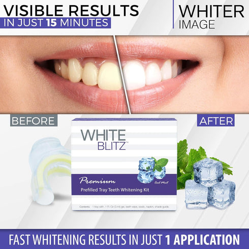 Whiter Image (3ml) White Blitz Prefilled Teeth Whitening Kit with Vacuum-Sealed Tray, Teeth Whitening Gel + Shade