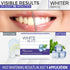 Whiter Image (3ml) White Blitz Prefilled Teeth Whitening Kit with Vacuum-Sealed Tray, Teeth Whitening Gel + Shade