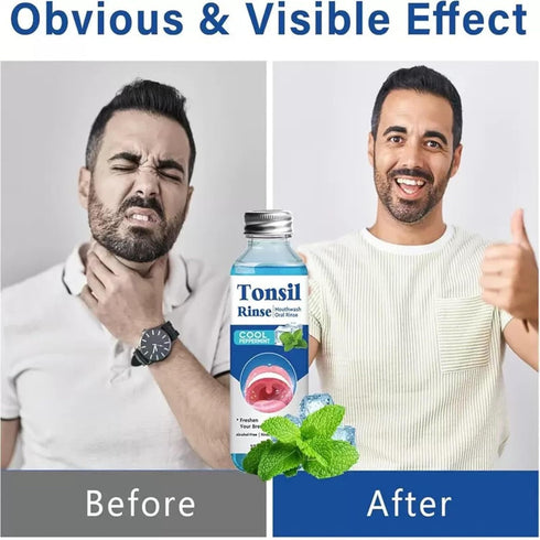 ZLSJJCLMZ Tonsil Stone Remover, Tonsil Stone Mouthwash to Help Soothe Tonsils, Oral Rinse Liquid for Eliminating Bad