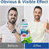 ZLSJJCLMZ Tonsil Stone Remover, Tonsil Stone Mouthwash to Help Soothe Tonsils, Oral Rinse Liquid for Eliminating Bad