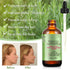 ZIXBMHYJ (2 Pack), Rosemary Essential Oil Rosemary Oil for Hair Growth & Skin Care, Face, Dry Scalp Treatment, Hair