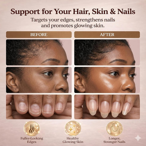 SUUDUUL Gummies (5000mg (30mcg), 60 Gummies Hair Growth for Black Women, with Biotin-Silica Complex Biotin) & Vitamin D