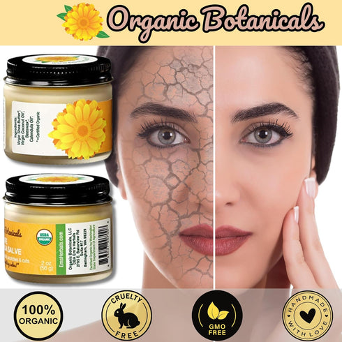 Organic Botanicals 2 Oz Pure Organic Calendula Salve Healing Balm - Calendula Cream Healing Hand Salve Ointment from